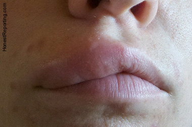 Fat Lip Journalism