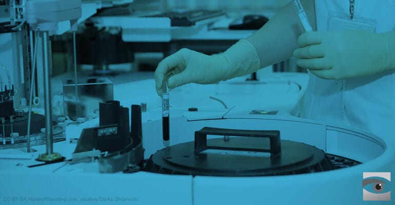 The Rudoren Test