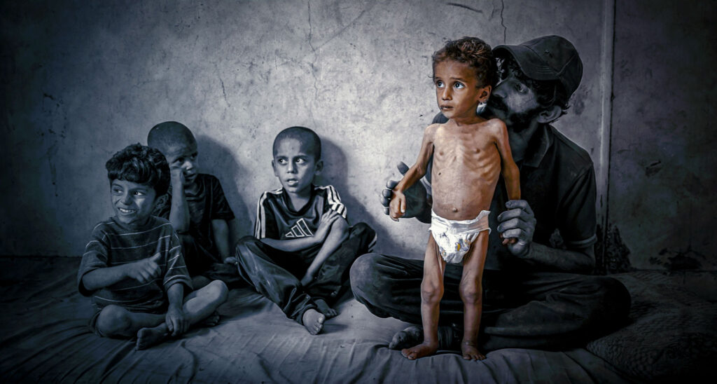 The Media’s Starving Gazan Images: Narrative & Reality
